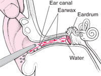 diagram of inner ear