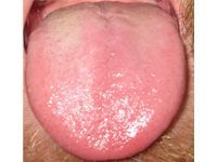 closeup of a tongue